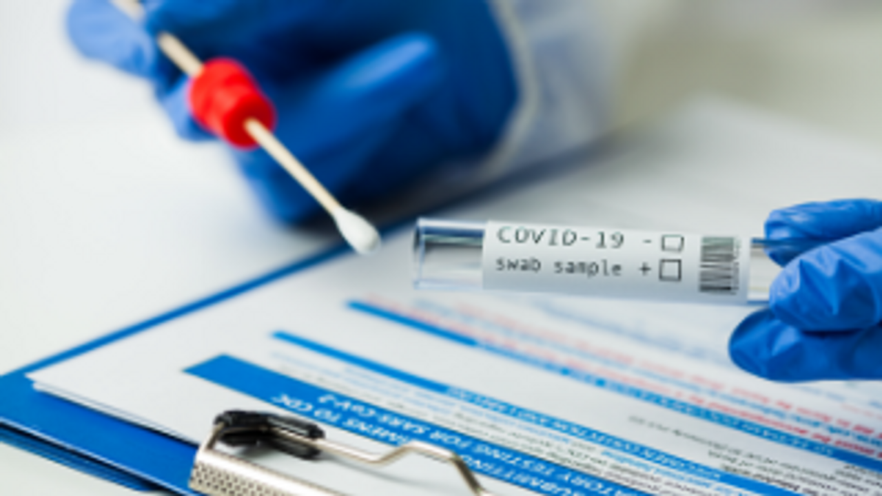 Prueba PCR Covid