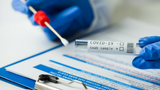 Prueba PCR Covid