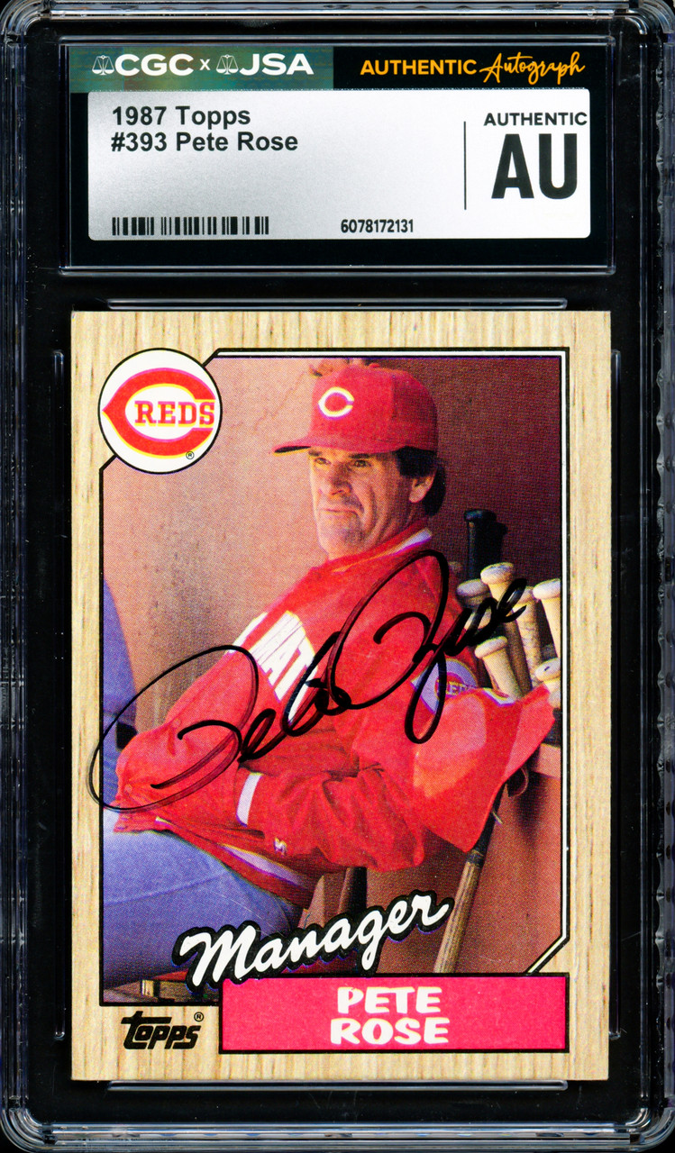 1987 topps pete rose cincinnati reds #393 rare baseball card ERROR 1987 Pete Rose. #393 error