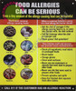 Food Allergies CAN BE SERIOUS BUILDING SIGN Food Allergies CAN BE SERIOUS BUILDING SIGN