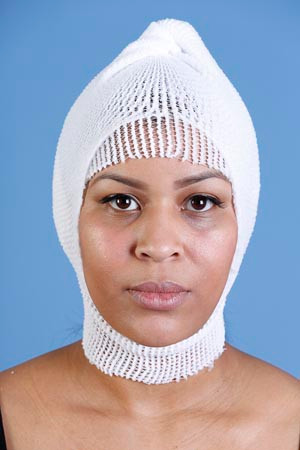 medi-tech international mt spandage tubular retainer net (10360854)