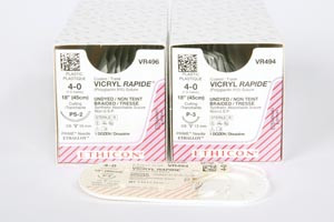 ethicon vicryl rapide (polyglactin 910) sutures (10113894)