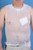 medi-tech international mt spandage tubular retainer net (10360865)
