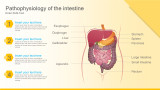 pathophysiology of intestine organs labelled
