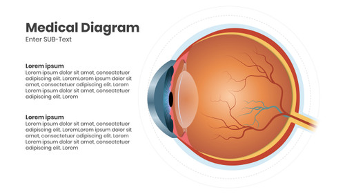 Medical Diagram - Eyes Retina Nerves - 2 Steps