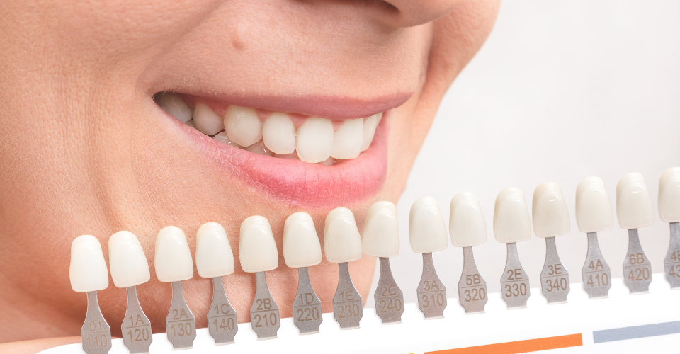 Geheimen van een stralende glimlach: Hoe whitening producten je glimlach transformeren