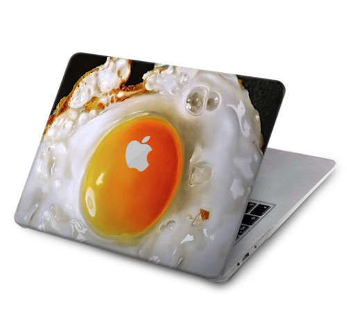 S2695 Fried Egg Hülle Schutzhülle Taschen für MacBook Pro 16″ - A2141