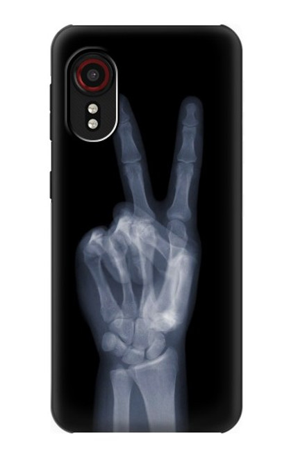 S3101 X-ray Peace Sign Fingers Hülle Schutzhülle Taschen für Samsung Galaxy Xcover 5