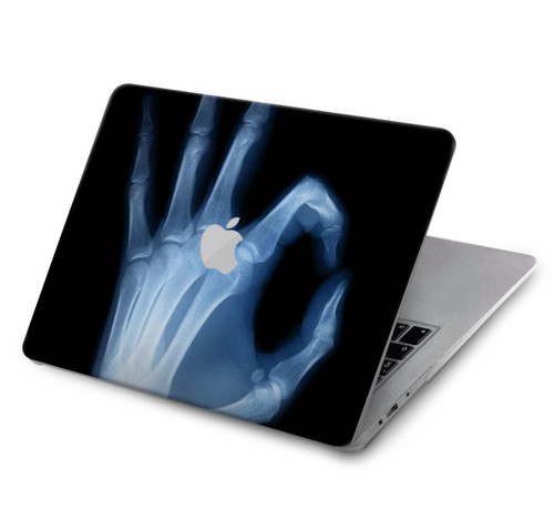 S3239 X-Ray Hand Sign OK Hülle Schutzhülle Taschen für MacBook Air 15″ (2023,2024,2025) - A2941, A3114, A3241