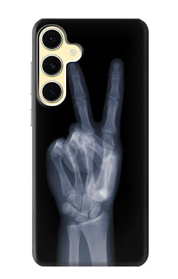S3101 X-ray Peace Sign Fingers Hülle Schutzhülle Taschen für Samsung Galaxy S24 FE