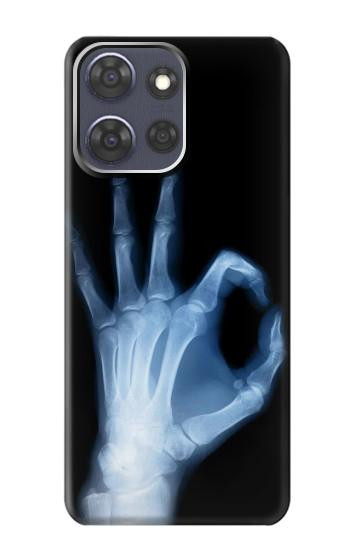 S3239 X-Ray Hand Sign OK Hülle Schutzhülle Taschen für Motorola Moto G Power (2025)