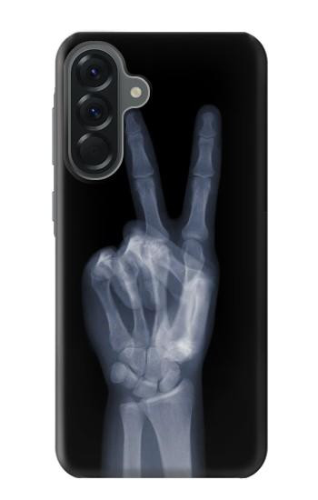 S3101 X-ray Peace Sign Fingers Hülle Schutzhülle Taschen für Samsung Galaxy A56