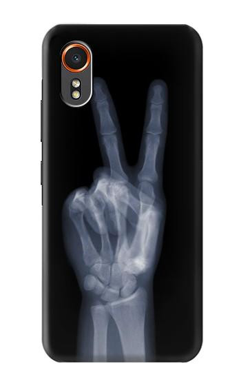 S3101 X-ray Peace Sign Fingers Hülle Schutzhülle Taschen für Samsung Galaxy XCover7