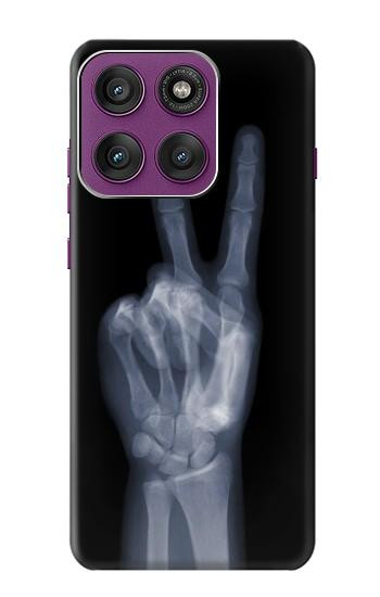 S3101 X-ray Peace Sign Fingers Hülle Schutzhülle Taschen für Motorola Edge 60 Pro