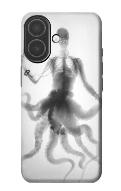 S1432 Skull Octopus X-ray Hülle Schutzhülle Taschen für iPhone 17