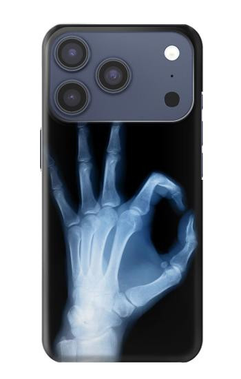 S3239 X-Ray Hand Sign OK Hülle Schutzhülle Taschen für iPhone 17 Pro, 18 Pro