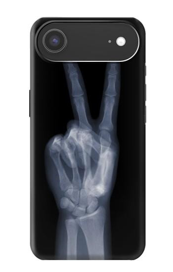S3101 X-ray Peace Sign Fingers Hülle Schutzhülle Taschen für iPhone Air