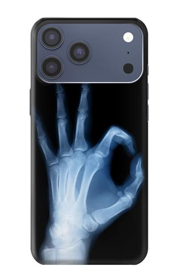 S3239 X-Ray Hand Sign OK Hülle Schutzhülle Taschen für iPhone 17 Pro Max, 18 Pro Max