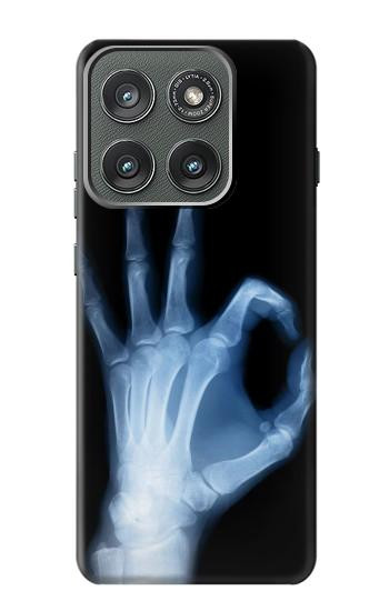 S3239 X-Ray Hand Sign OK Hülle Schutzhülle Taschen für Motorola Edge (2025)
