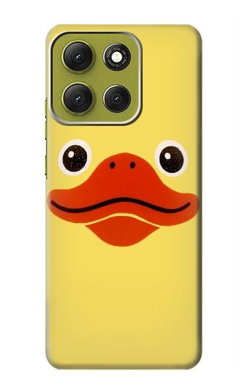 S1922 Duck Face Hülle Schutzhülle Taschen für Motorola Moto G86