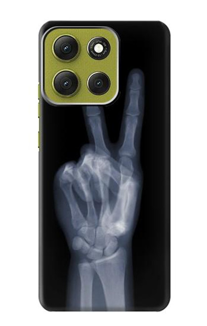 S3101 X-ray Peace Sign Fingers Hülle Schutzhülle Taschen für Motorola Moto G86
