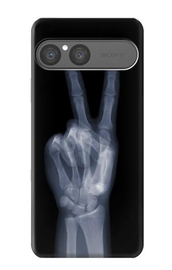 S3101 X-ray Peace Sign Fingers Hülle Schutzhülle Taschen für Sony Xperia 10 VII, 10 VIII