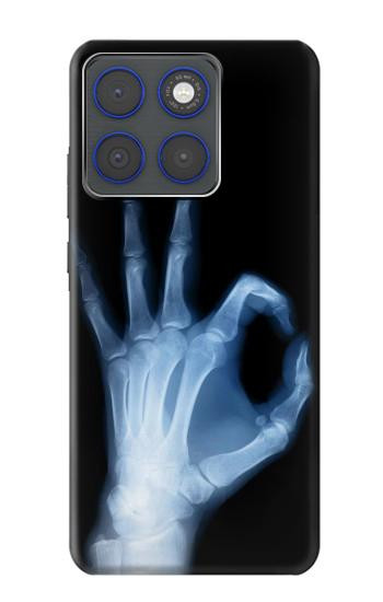 S3239 X-Ray Hand Sign OK Hülle Schutzhülle Taschen für Motorola Edge 70