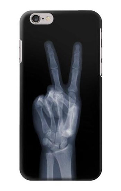 S3101 X-ray Peace Sign Fingers Hülle Schutzhülle Taschen für iPhone 6 Plus, 6S Plus