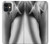 S1023 Gorgeus Sexy Girl Hülle Schutzhülle Taschen für iPhone 11