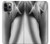 S1023 Gorgeus Sexy Girl Hülle Schutzhülle Taschen für iPhone 11 Pro