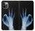 S3239 X-Ray Hand Sign OK Hülle Schutzhülle Taschen für iPhone 12, iPhone 12 Pro