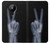 S3101 X-ray Peace Sign Fingers Hülle Schutzhülle Taschen für Nokia 5.3