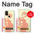 S0815 Pregnant Art Hülle Schutzhülle Taschen für OnePlus Nord N10 5G