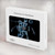 S1111 Soccer X-ray Hülle Schutzhülle Taschen für MacBook Air 13″ - A1369, A1466