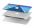 S2429 Swimming Pool Hülle Schutzhülle Taschen für MacBook Pro Retina 13″ - A1425, A1502