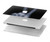 S3101 X-ray Peace Sign Fingers Hülle Schutzhülle Taschen für MacBook Pro Retina 13″ - A1425, A1502