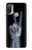 S3101 X-ray Peace Sign Fingers Hülle Schutzhülle Taschen für Motorola Moto E20,E30,E40