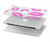 S2214 Pink Lips Kisses Hülle Schutzhülle Taschen für MacBook Air 13″ (2022,2025) - A2681, A3113, A3240