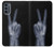 S3101 X-ray Peace Sign Fingers Hülle Schutzhülle Taschen für Motorola Moto G62 5G