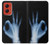 S3239 X-Ray Hand Sign OK Hülle Schutzhülle Taschen für Motorola Moto G Stylus 5G (2024)