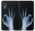 S3239 X-Ray Hand Sign OK Hülle Schutzhülle Taschen für Samsung Galaxy XCover7