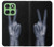 S3101 X-ray Peace Sign Fingers Hülle Schutzhülle Taschen für Motorola Edge 60
