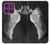 S1593 Ballet Pointe Shoe Hülle Schutzhülle Taschen für Motorola Edge 60 Pro