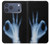 S3239 X-Ray Hand Sign OK Hülle Schutzhülle Taschen für iPhone 17 Pro Max