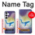 S3802 Dream Whale Pastel Fantasy Hülle Schutzhülle Taschen für Samsung Galaxy S25 FE
