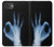 S3239 X-Ray Hand Sign OK Hülle Schutzhülle Taschen für iPhone 17e