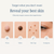 Wart Mole Vanish