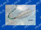 PRECISE PRO Rx Nitinol Carotid Stent System - 6mm x 30mm x 135cm