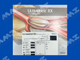 ULTRAVERSE RX PTA Dilatation Catheter - 4Fr x 2mm x 40mm x 200cm
