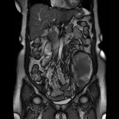 NYU Langone's Clinical Updates in Body, Chest, and Oncologic Imaging